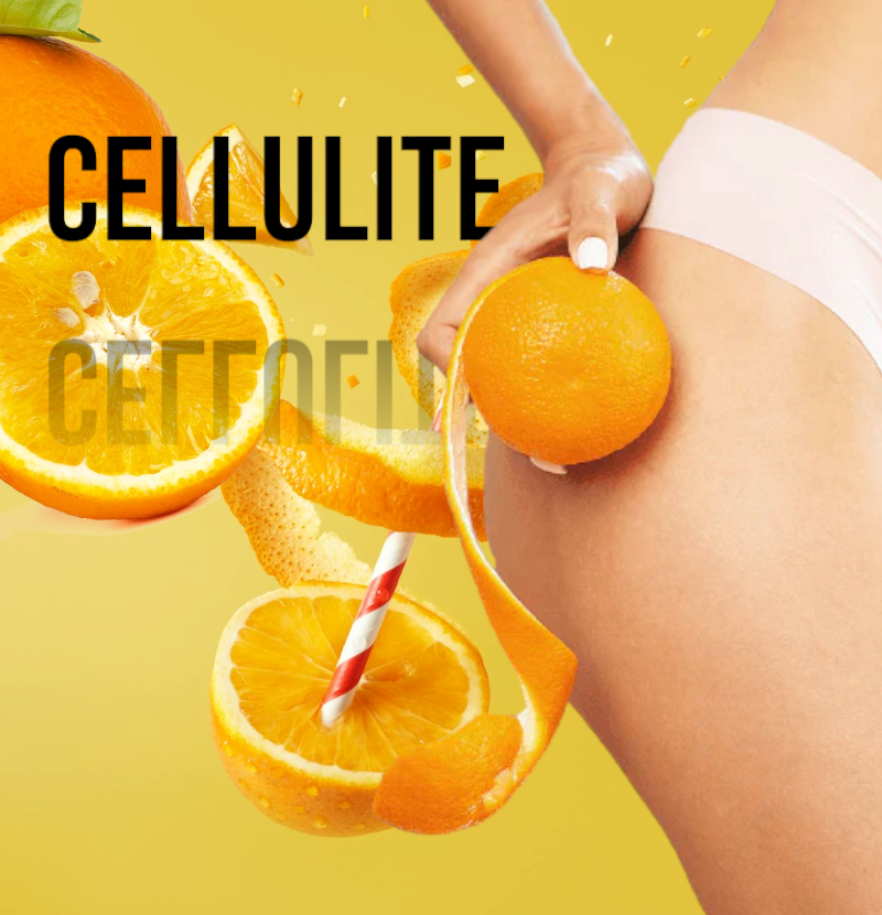 Behandlung von Cellulite: So wird man sie los